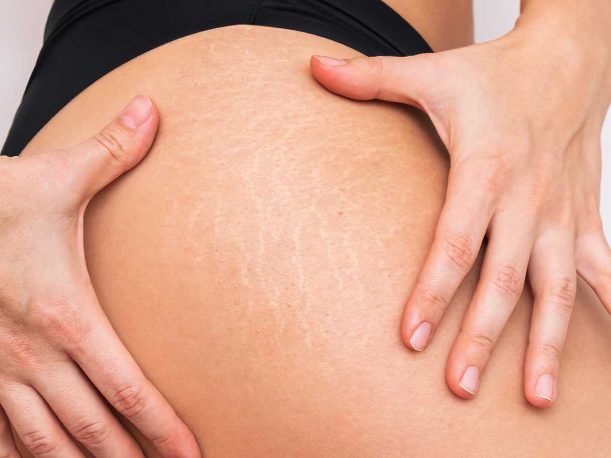 Genius Radiofrequency